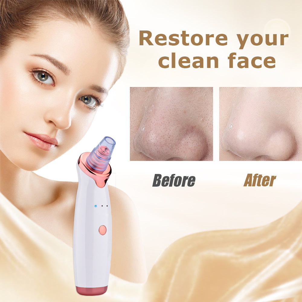 Blackhead removal kit featuring six interchangeable suction heads and filter cotton for thorough pore cleansing